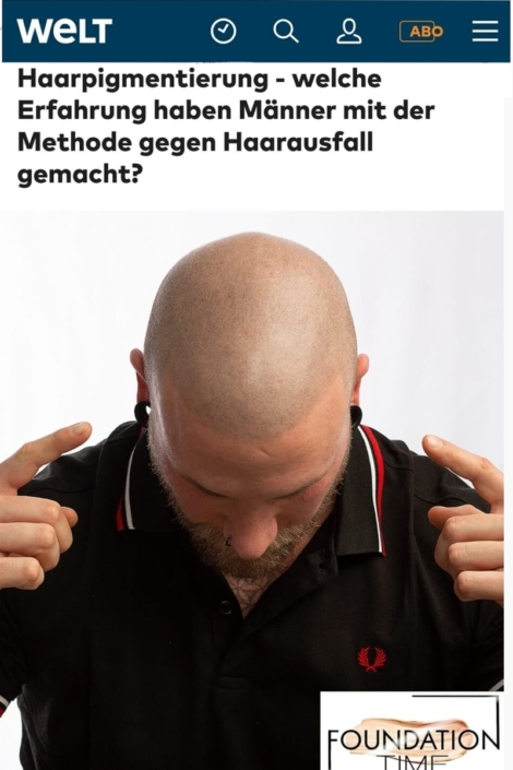WELT: Haarpigmentierung - welche Erfahrung haben Männer mit der Methode gegen Haarausfall gemacht?