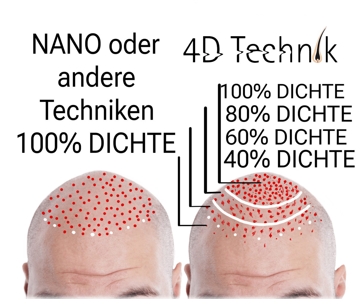 Nano-Pigmentierung oder andere Techniken zur Haarpigmentierung